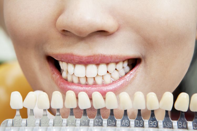 Kontrola bělosti zubů