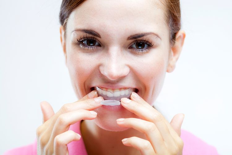 Procedura bělení zubů