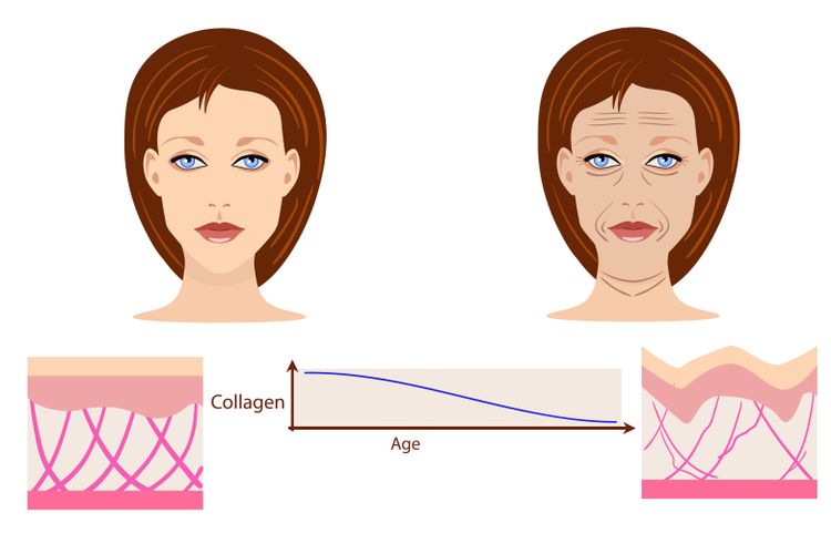 Přirozená produkce kolagenu klesá se zvyšujícím se věkem