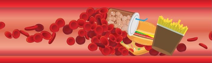 Vysoký cholesterol v krvi a nevhodné potraviny