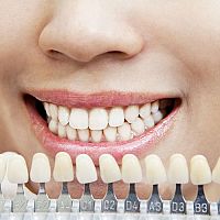 Nejlepší domácí účinné bělení zubů? Peroxidem ne, jedlou sodu chválí recenze
