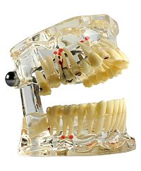 Miradent Fantom DE LUXE, transparentní
