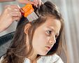 Jak se zbavit vší ve vlasech? Ocet i šampony na rychlé odstranění problému