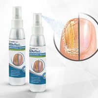 Wellneo Iza Effect proti plísni nohou a nehtů – recenze a zkušenosti